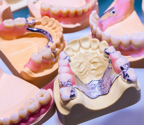 Partial dentures | Removable Dentures | Different Designs | My Dental Advocate