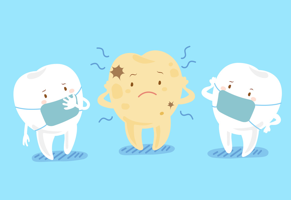Tooth Decay Cartoon | How to Fix a Cavity: Treatment Solutions & Costs | My Dental Advocate