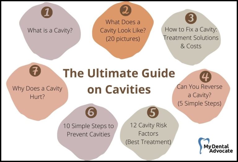 Cavities | The Ultimate Guide (Content Hub)