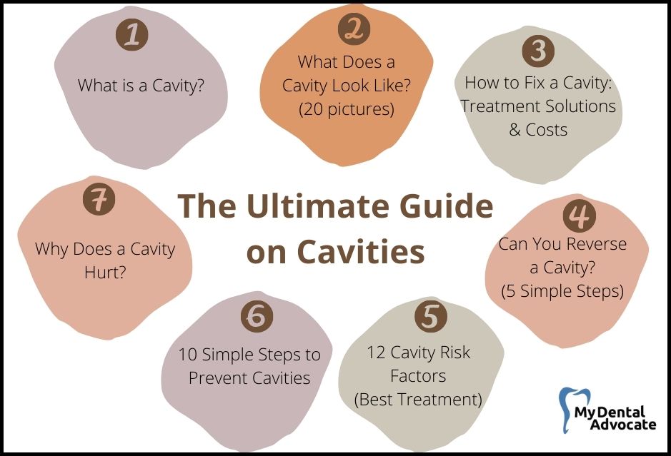 The Ultimate Guide On Cavities | 7 Subsections on Cavities