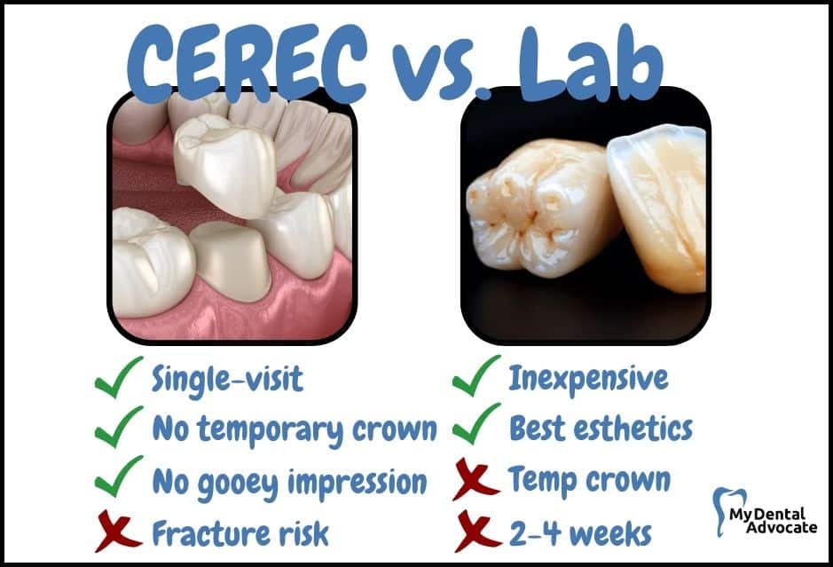 CEREC vs. Lab Porcelain Crown | My Dental Advocate