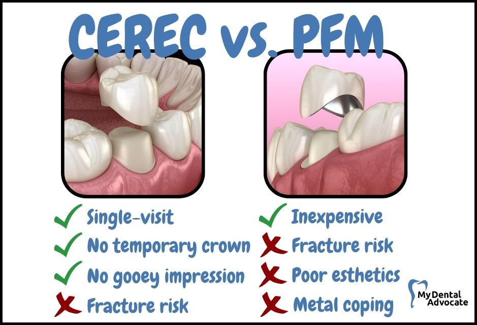 CEREC vs. PFM Crown Pros/Cons | My Dental Advocate