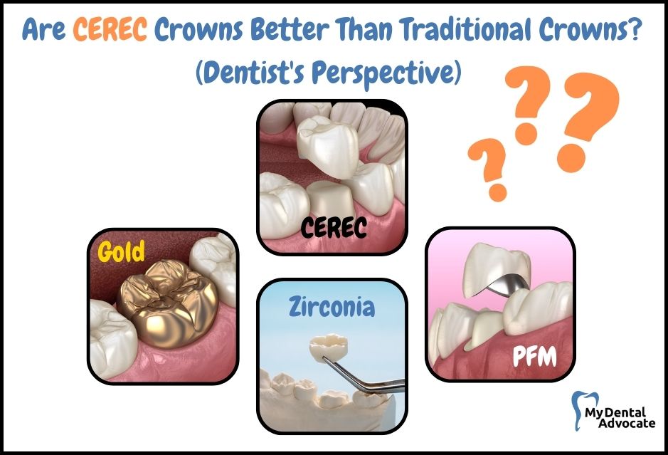 CEREC vs. Traditional Crowns Pros/Cons | My Dental Advocate