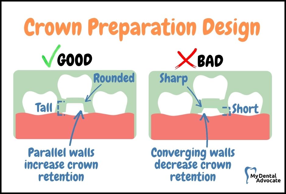 Crown Preparation Design | My Dental Advocate