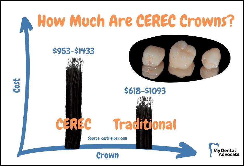 CEREC Crown Cost Versus Traditional Crown | My Dental Advocate