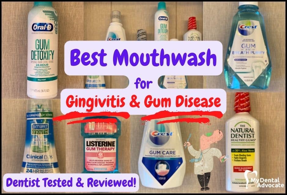 6 Best Mouthwashes for Gingivitis & Gum Disease 2022 MDA