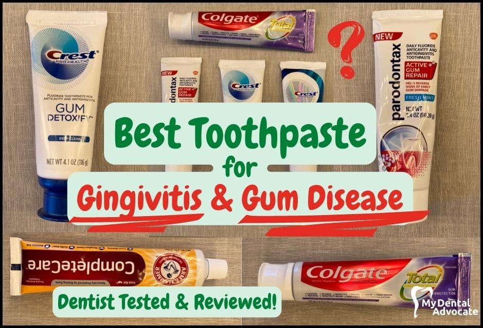 Best toothpaste for gingivitis & gum disease | My Dental Advocate