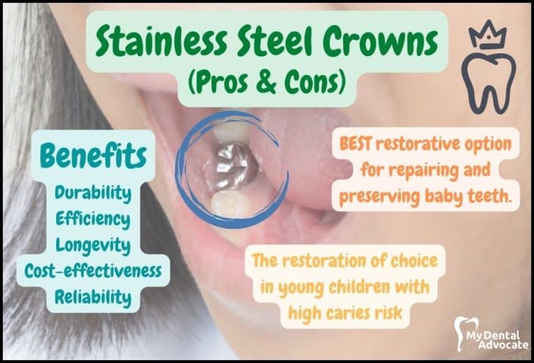 Stainless Steel Crowns For Kids Pros Cons And What To Expect Stainless Steel Crowns For Kids Pros Cons And What To Expect