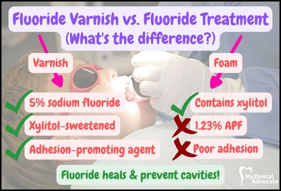 Fluoride Varnish vs. Fluoride Treatment (Differences) MDA