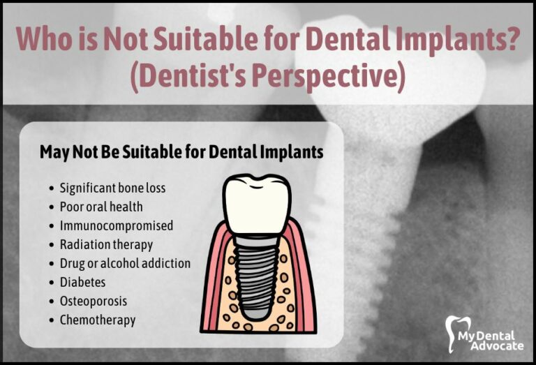 Who is Not Suitable for Dental Implants? (Dentist’s Perspective)