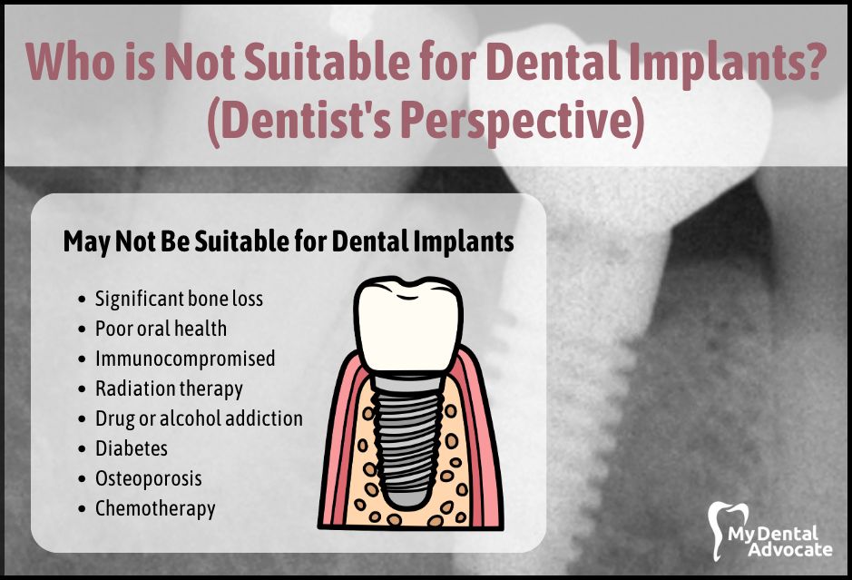 The Ultimate List of 30 Foods That Surprisingly Stain Teeth | My Dental Advocate