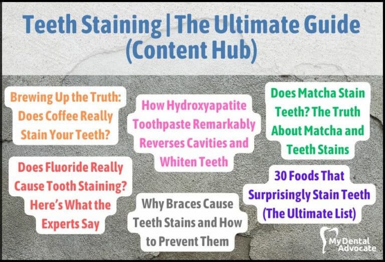 Teeth Staining | The Ultimate Guide (Content Hub)