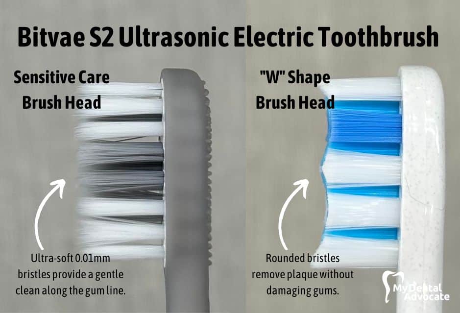 Bitvae S2 Ultrasonic Electric Toothbrush Review | My Dental Advocate