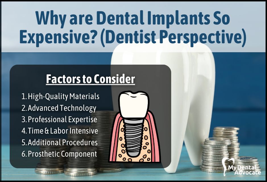 Why are Dental Implants So Expensive? (Dentist Perspective) | My Dental Advocate