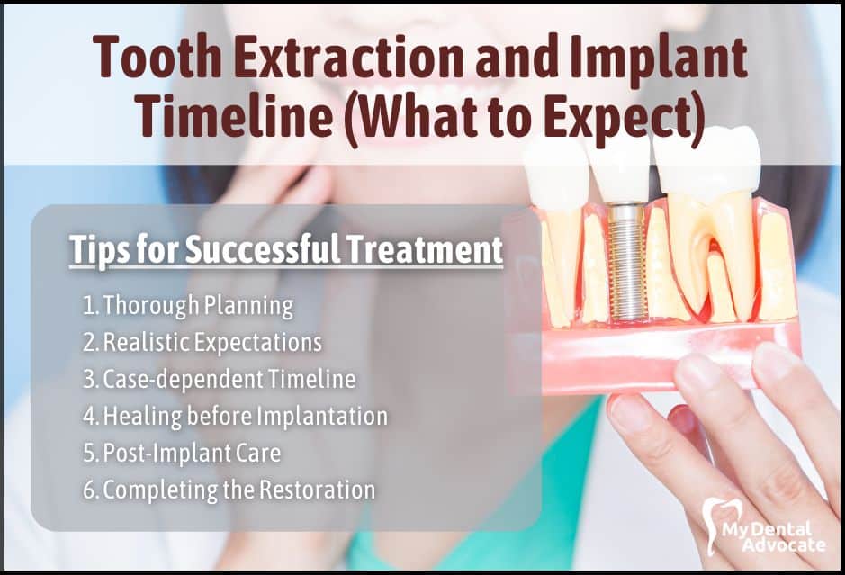 Tooth Extraction and Implant Timeline (What to Expect) | My Dental Advocate