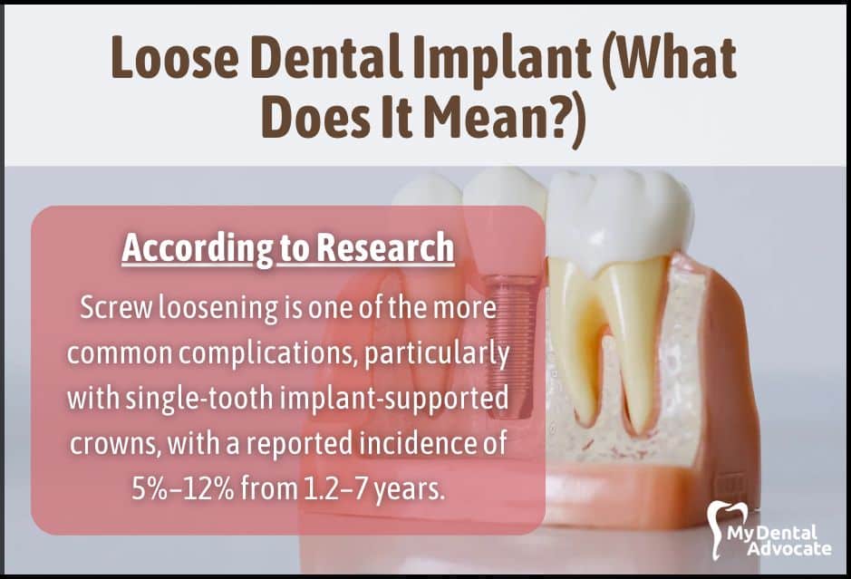 Loose Dental Implant (What Does it Mean?) | My Dental Advocate