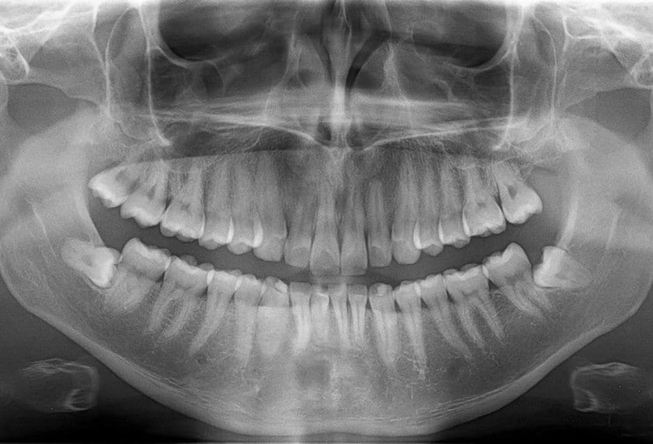 dental radiology fmx