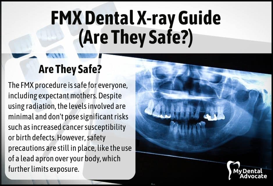 ☢️ FMX Dental X-ray Guide (Are They Safe?)