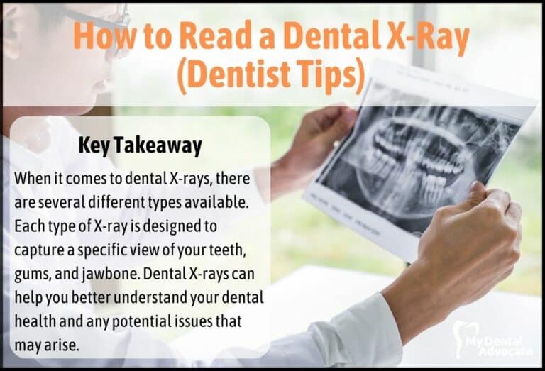 How to Read a Dental X-Ray (Dentist Tips)