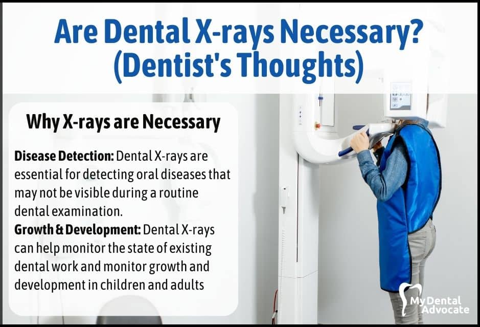 Are Dental X-rays Necessary? (Dentist's Thoughts) | My Dental Advocate