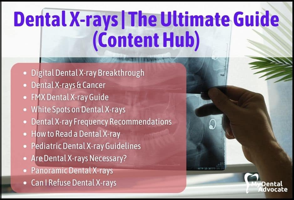 Dental X-rays | The Ultimate Guide | My Dental Advocate