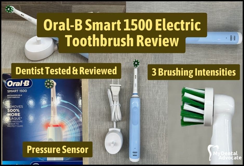 Oral-B Smart 1500 Electric Toothbrush Review | My Dental Advocate